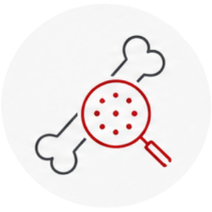 Knochendichtemessung (DXA) Knochendichtemessung (DXA)